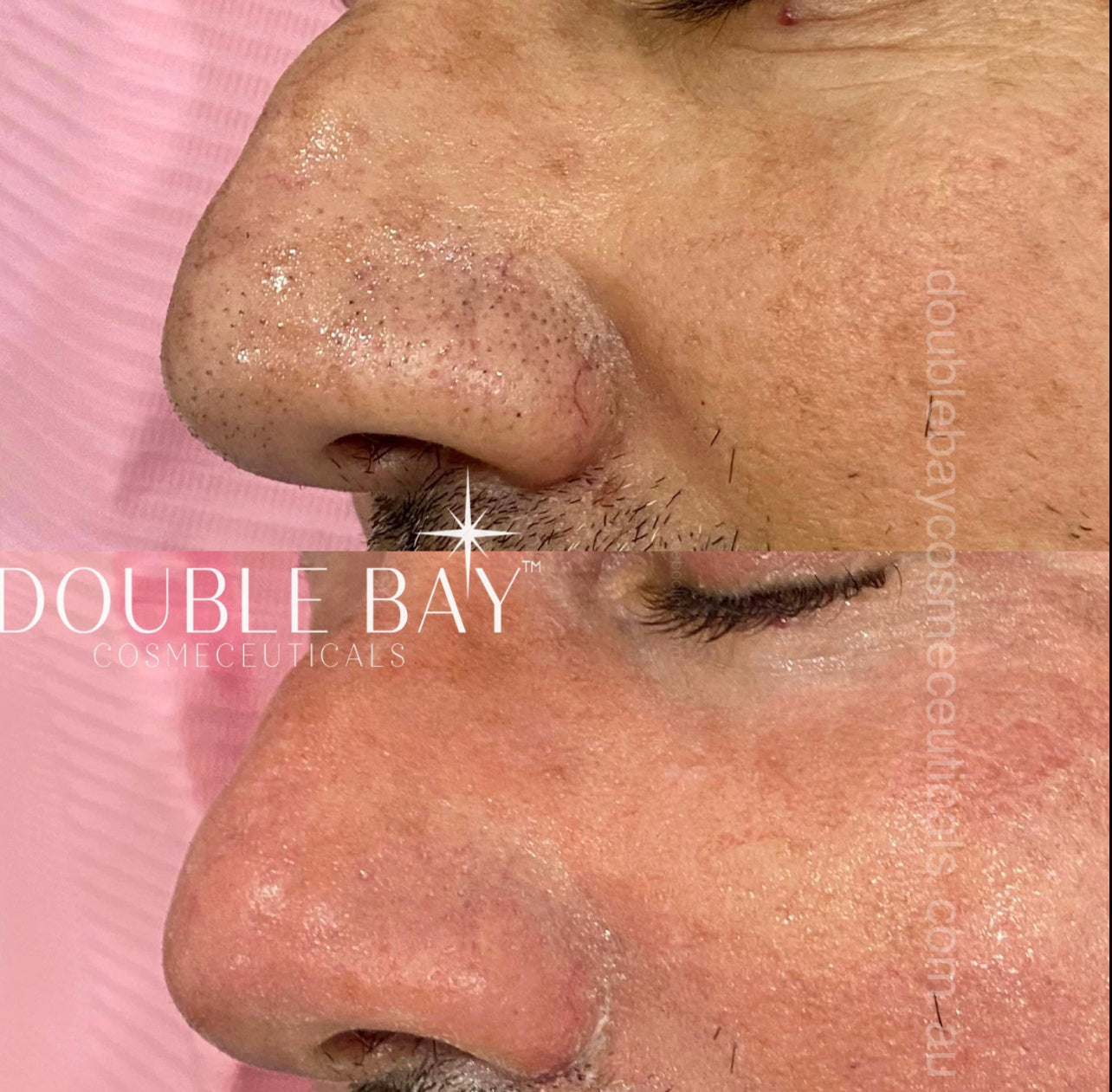 Mens Over 30s Protocol