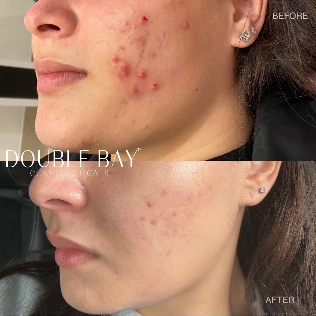 Encapsulated Retinol 1% Serum 20ml