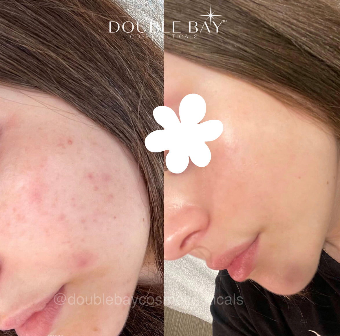 Give Me Strength Barrier Protocol