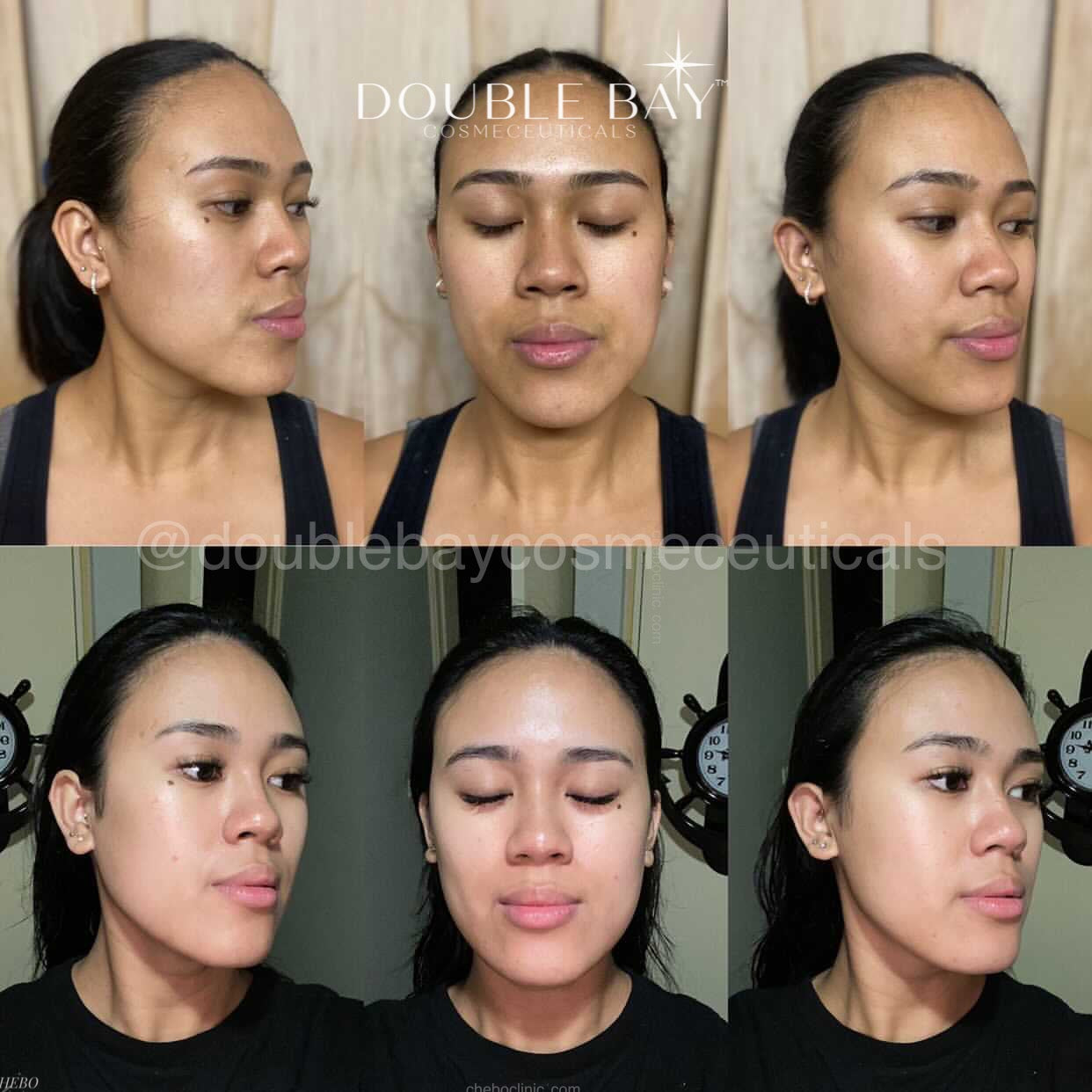 Ubiquinone 2% + LicoriBright Cream