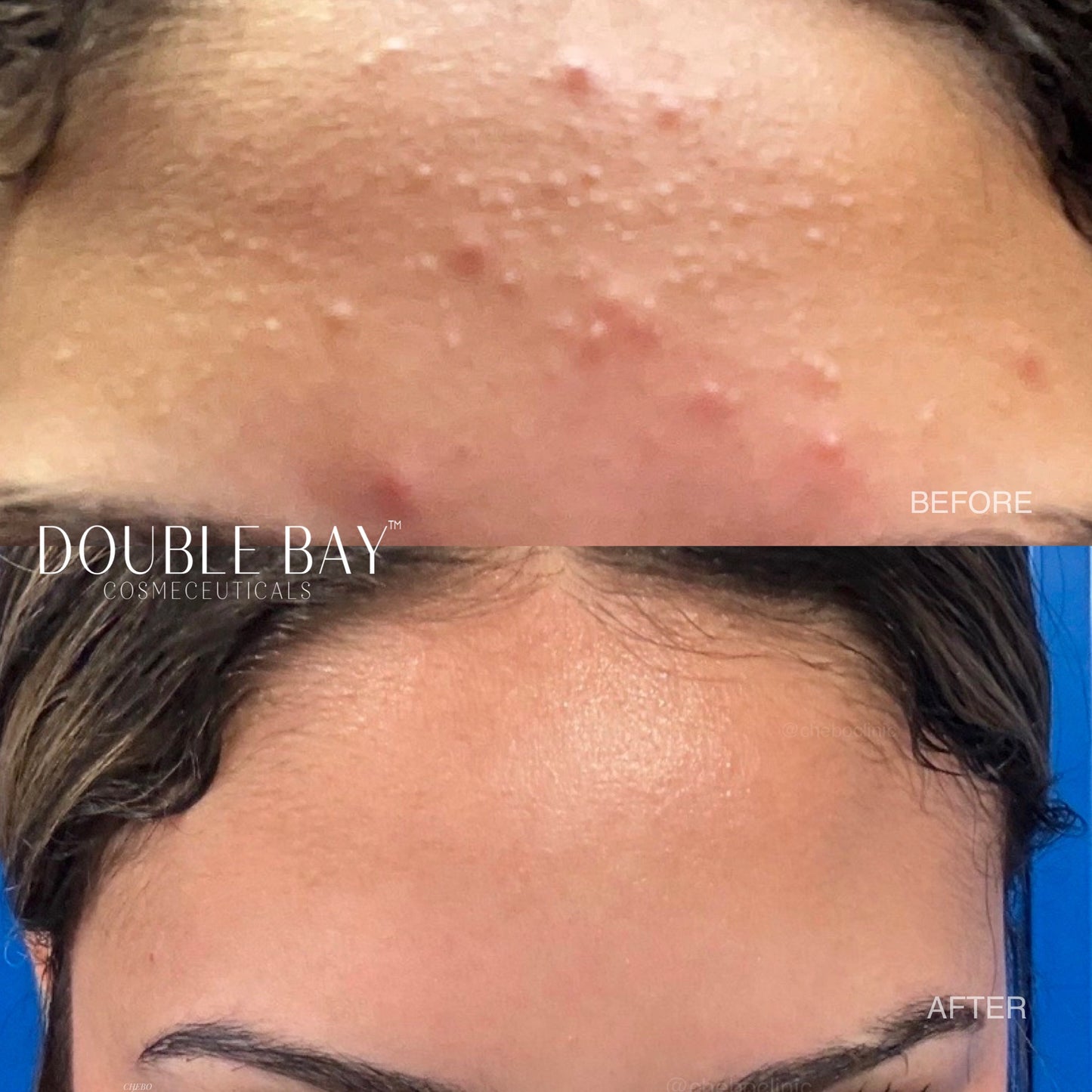 GlySilic Superficial Nightly Peel Pads