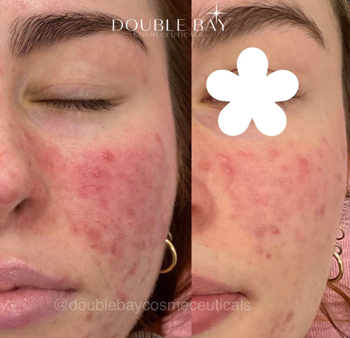 Skin Mistake Repair Protocol