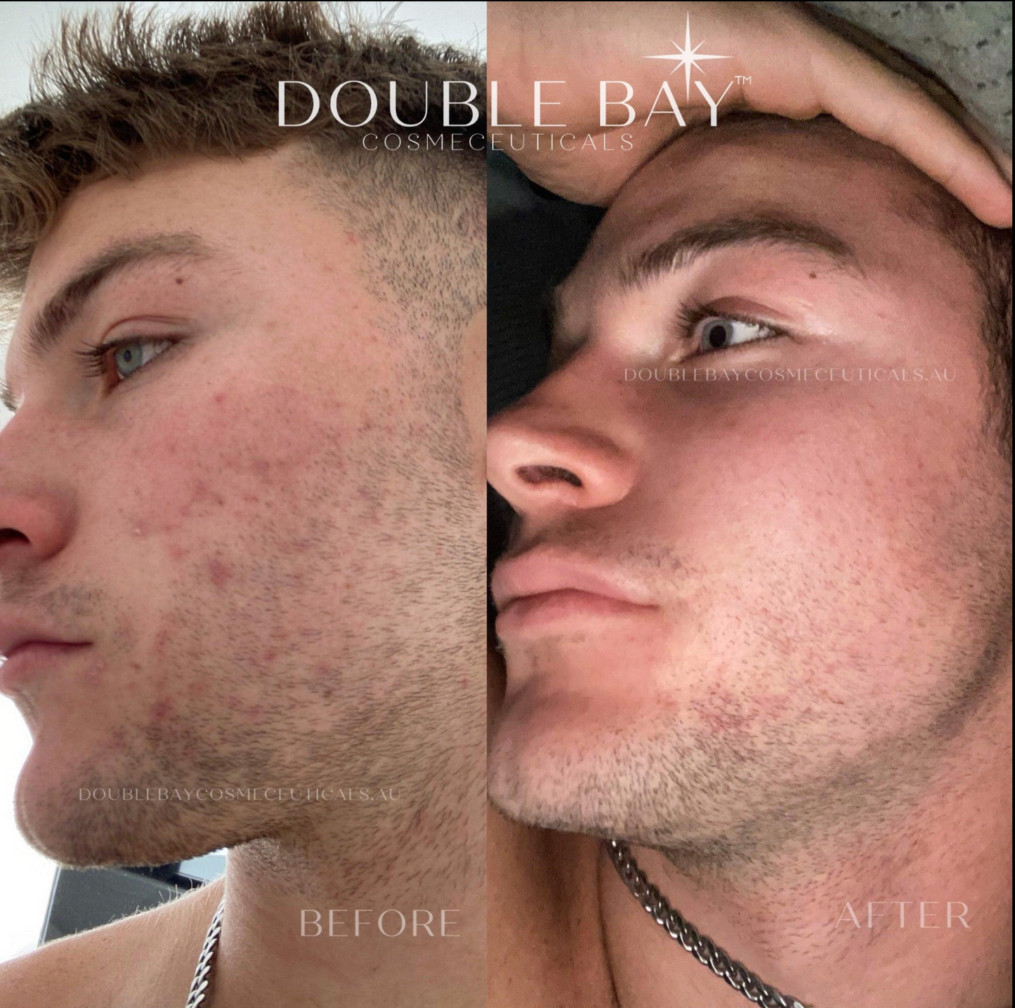 HERO Ectoin 1% + Saffron 1% Super Serum