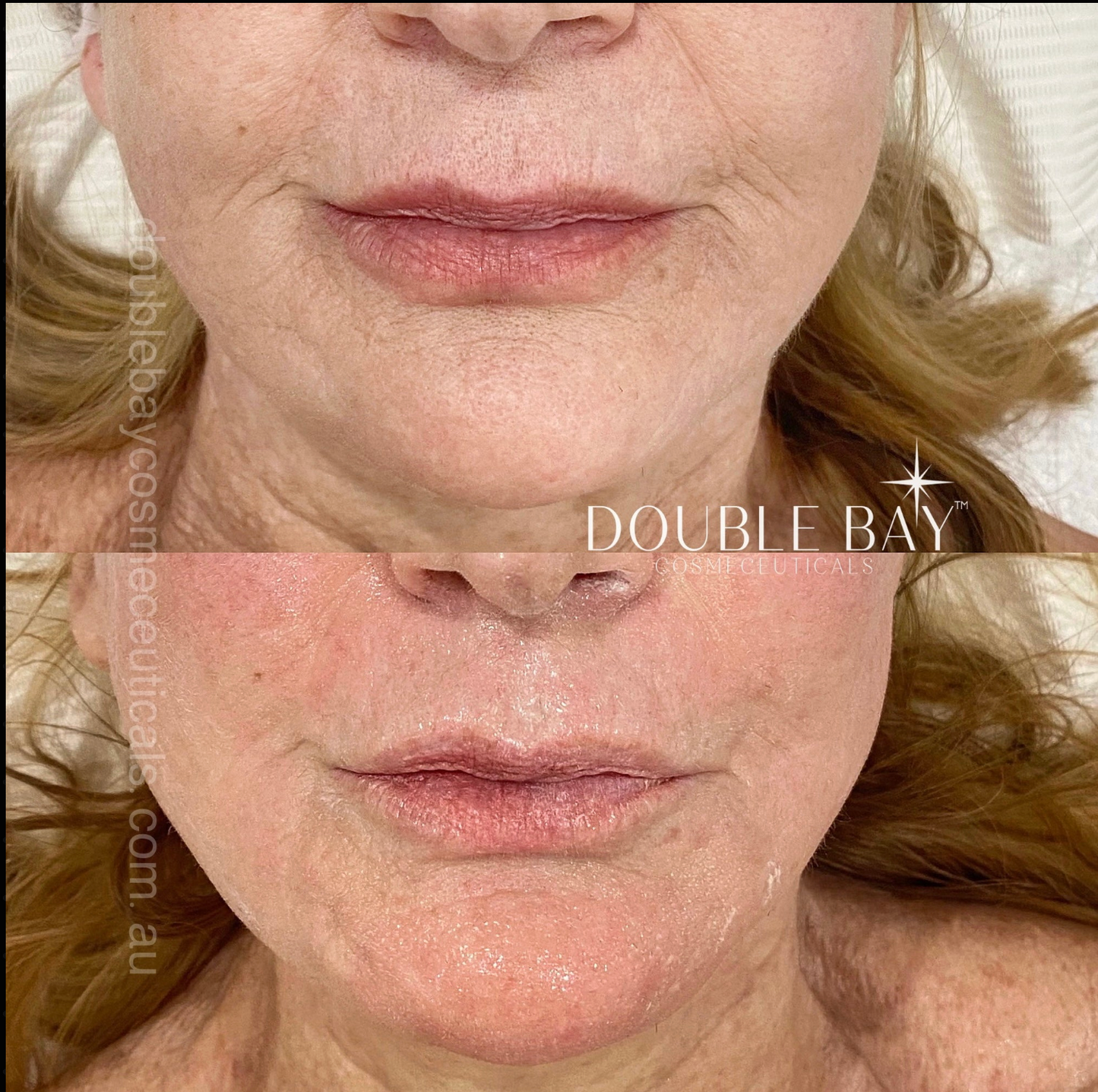 Intense Copper Binding GHK-Cu 5% + Tetrapeptide-7 5%  Cellular Repair Serum
