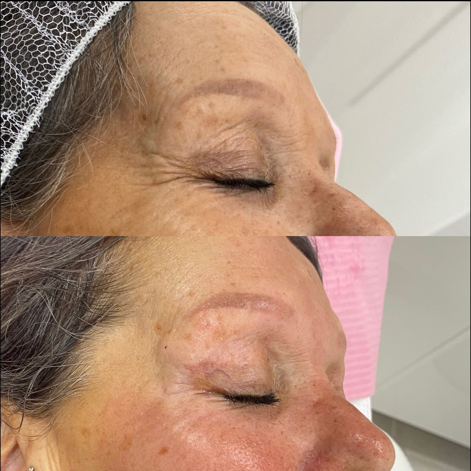Before and after Image 3