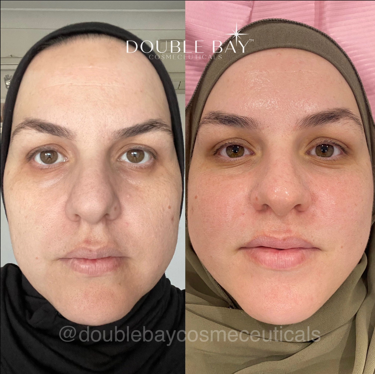 Before and after Image 2