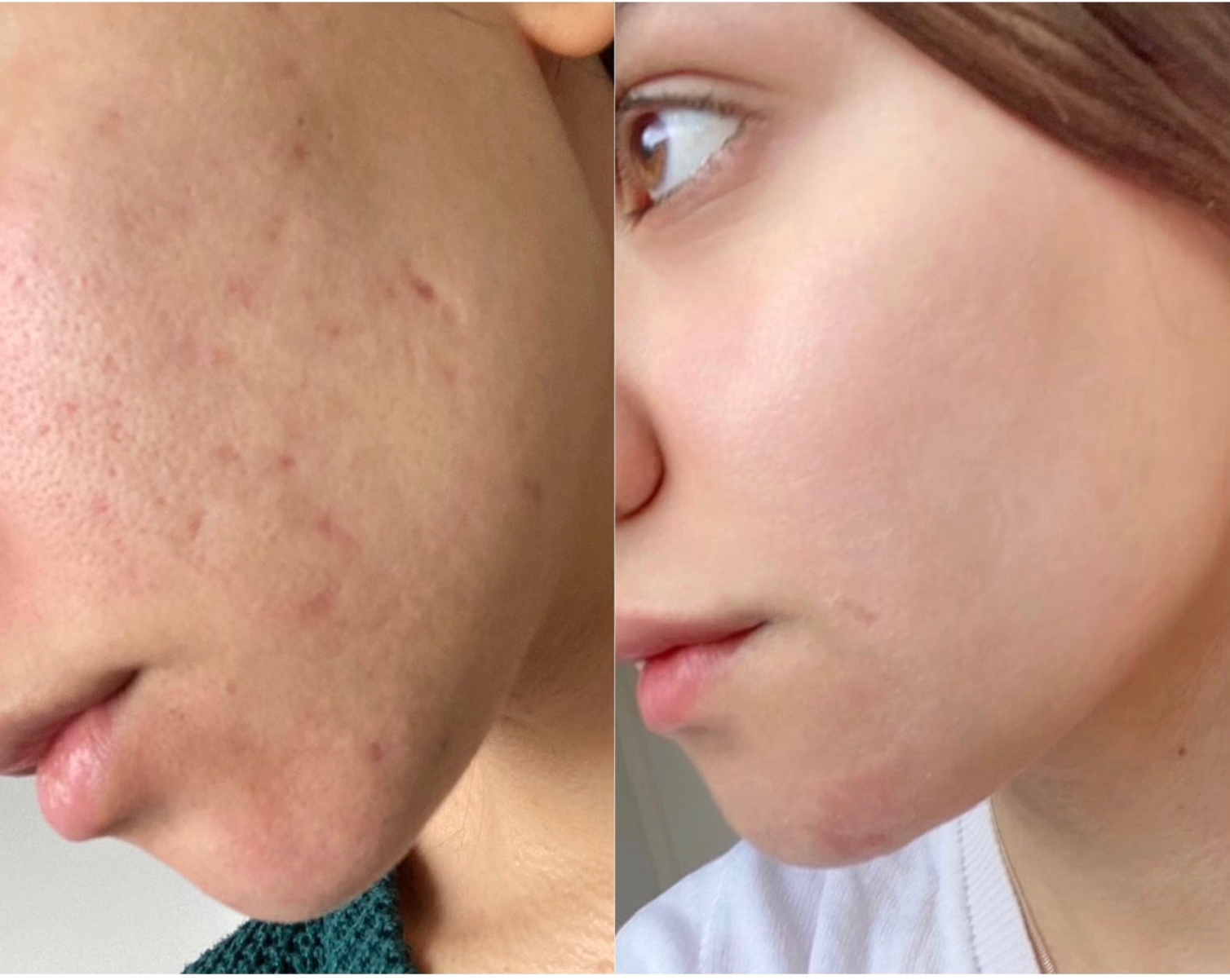 Before and after Image 1