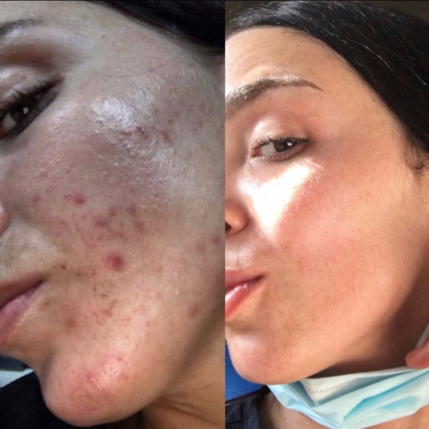 Pro Stubborn Red/Dark Mark Duo