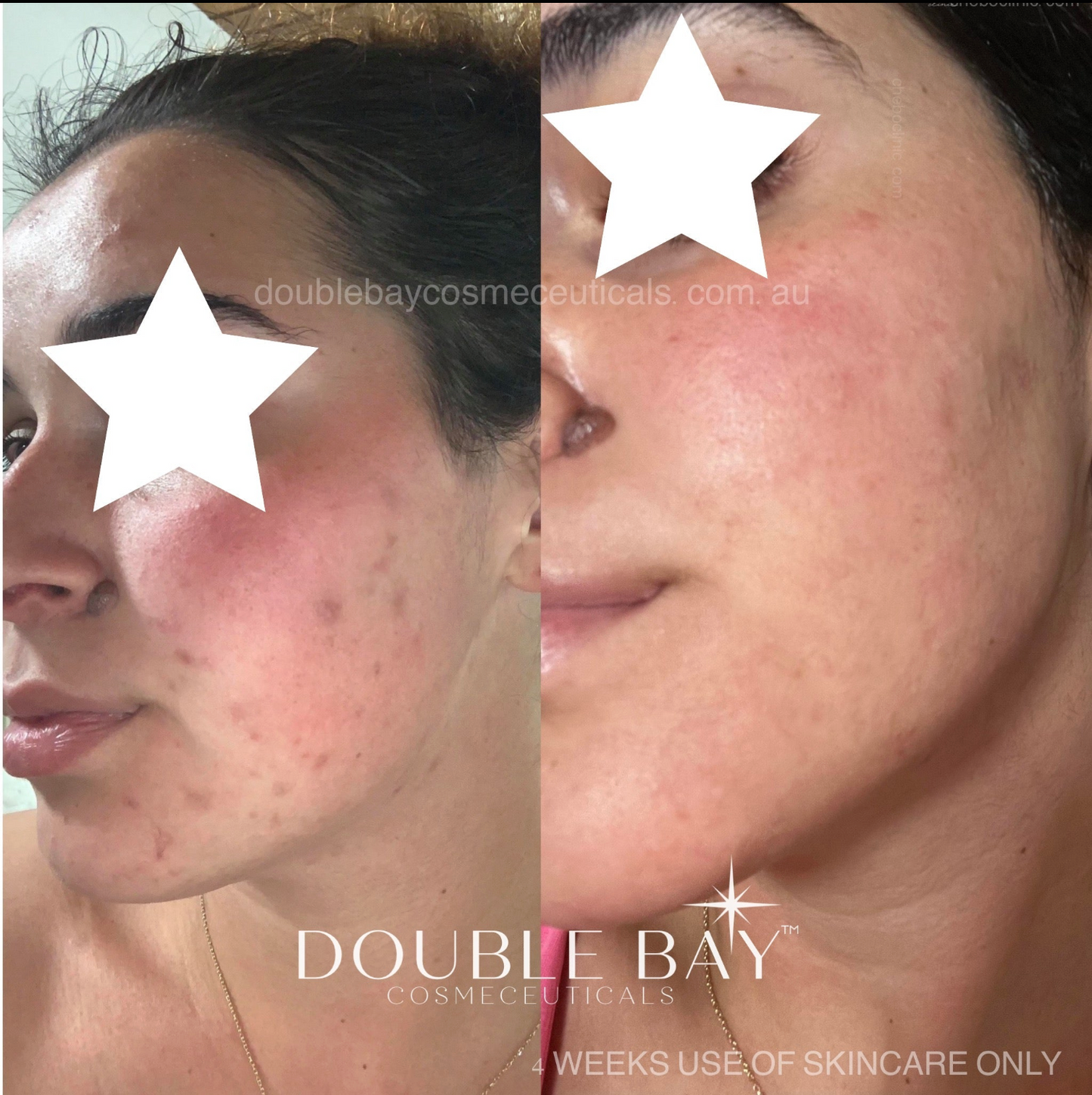 Copper Tripeptide 1.5% + Peonie 2% Jelly Cleanser