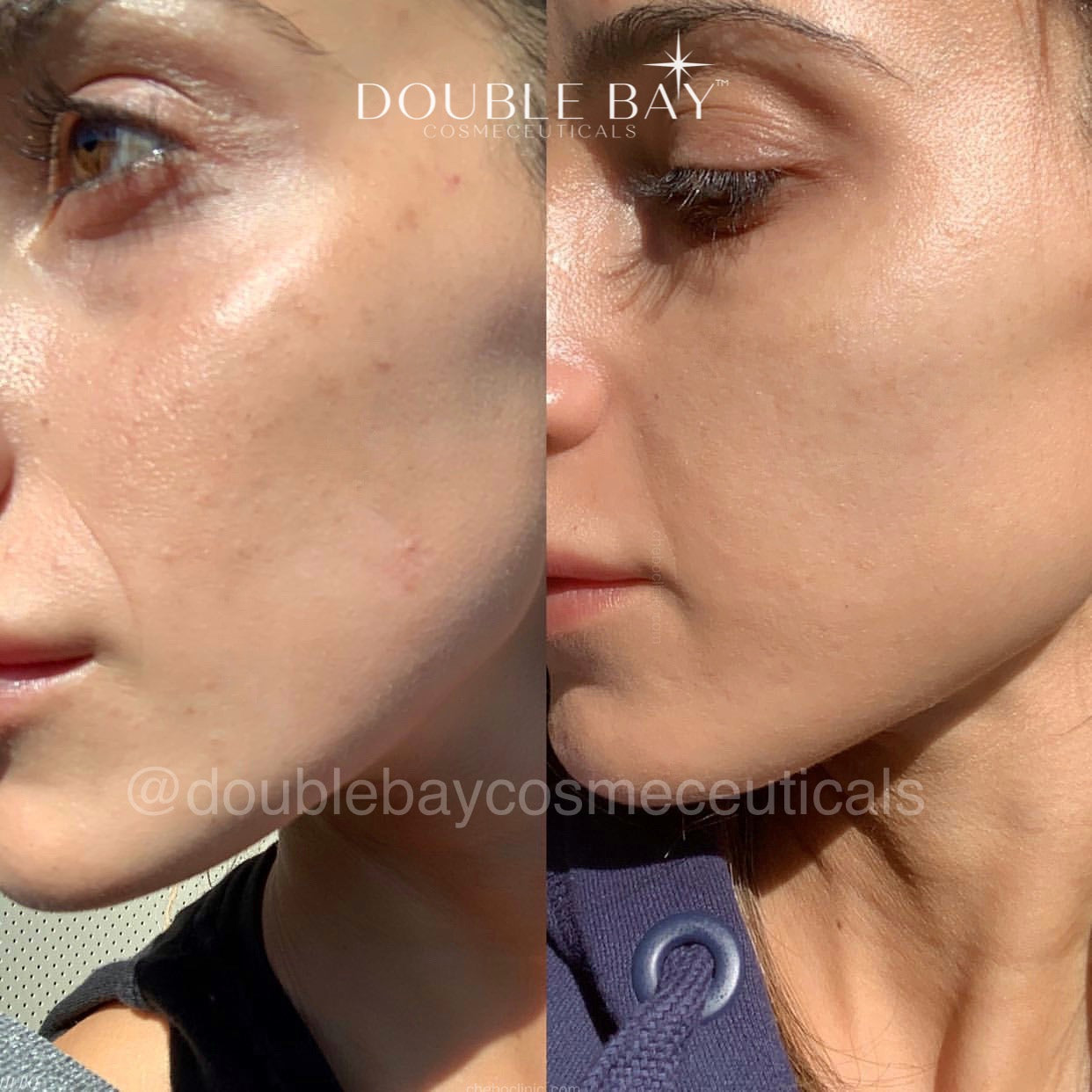 3 Step Intense Brightening Protocol