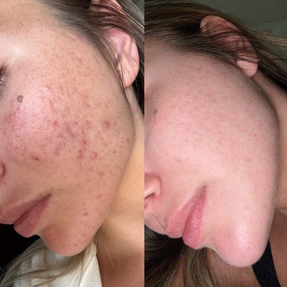 The Complete Ritual: Full-Spectrum Skincare Essentials