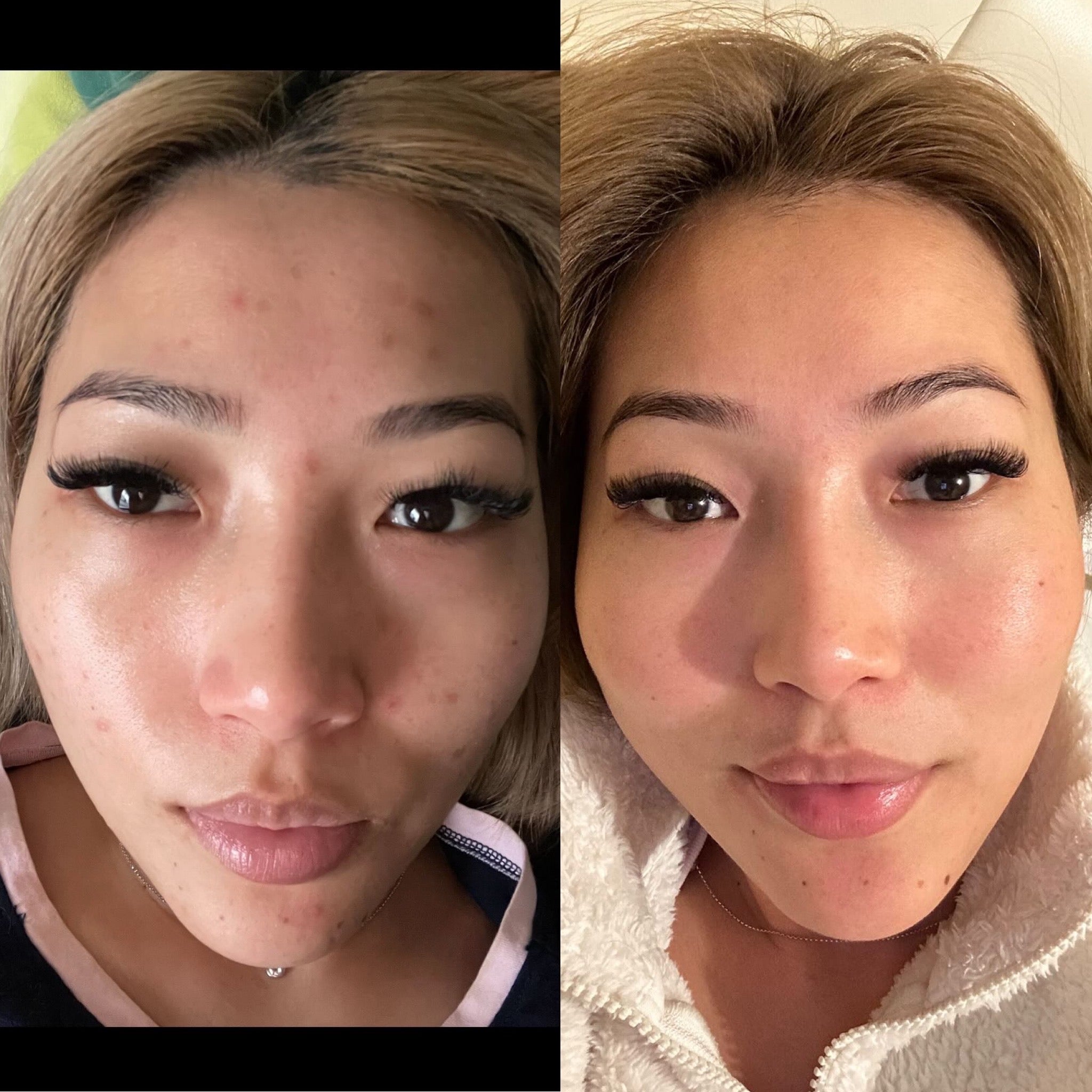 Before and after Image 2