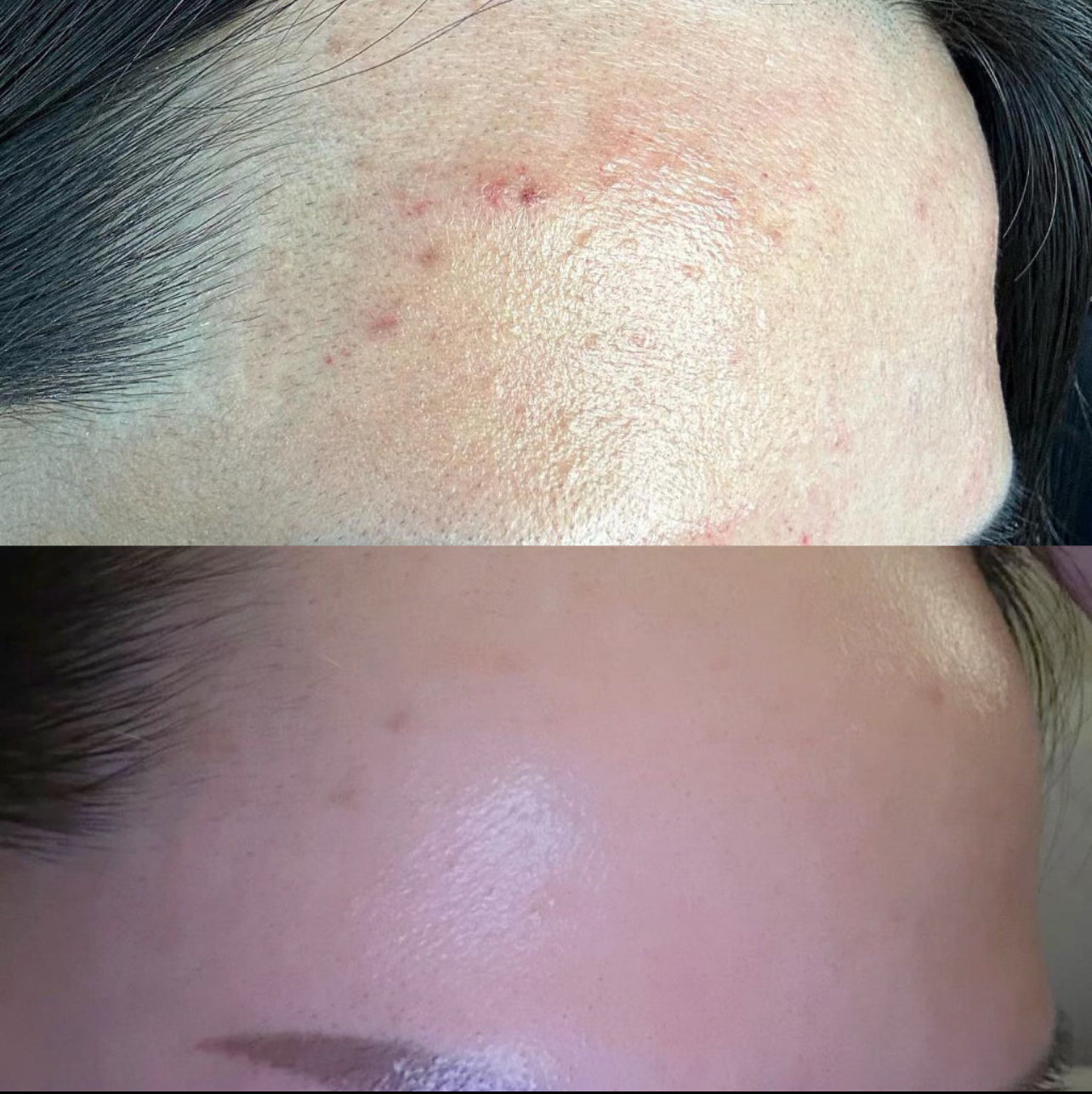Before and after Image 4
