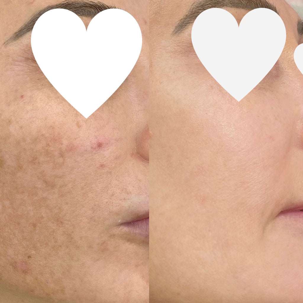 Before and after Image 3