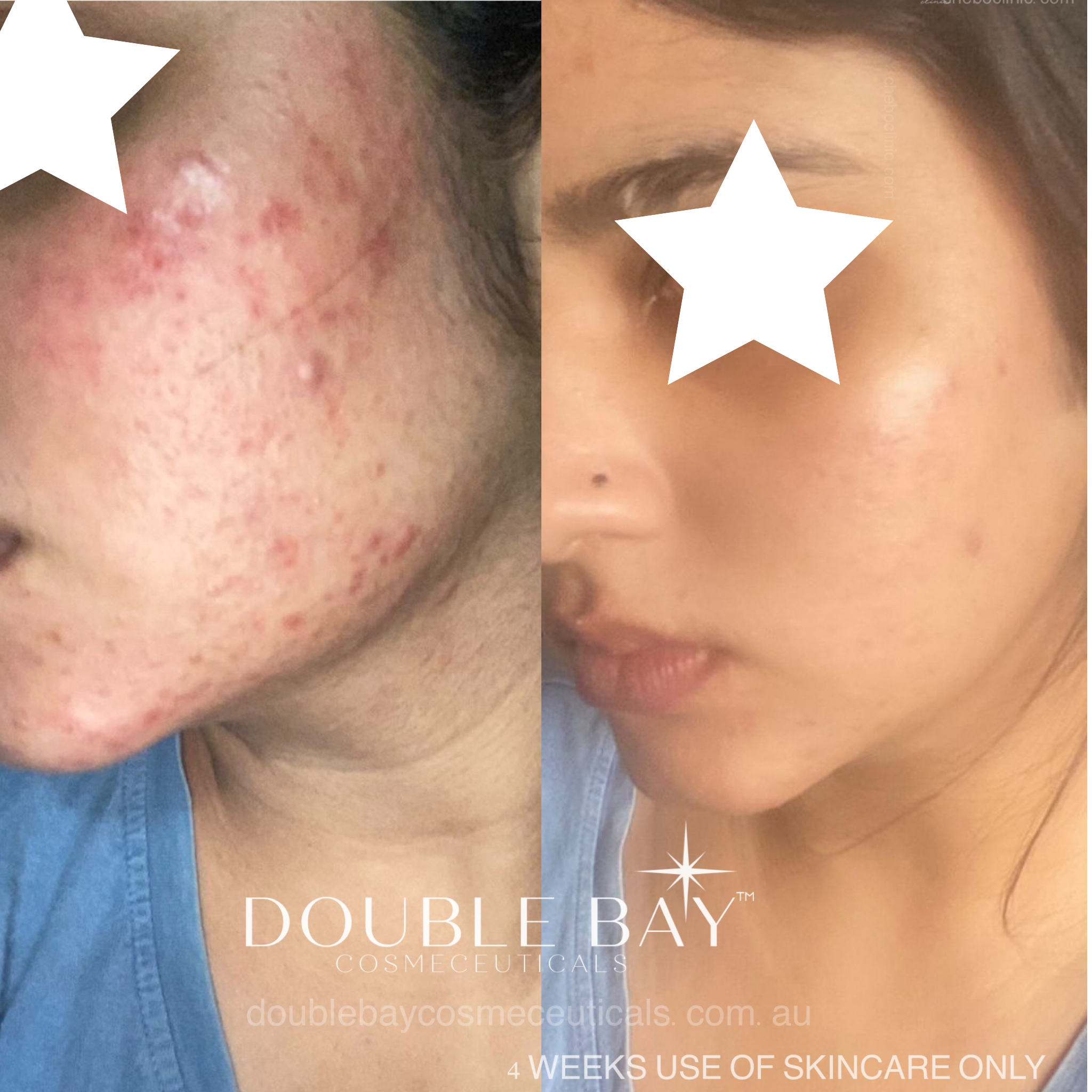 Before and after Image 3