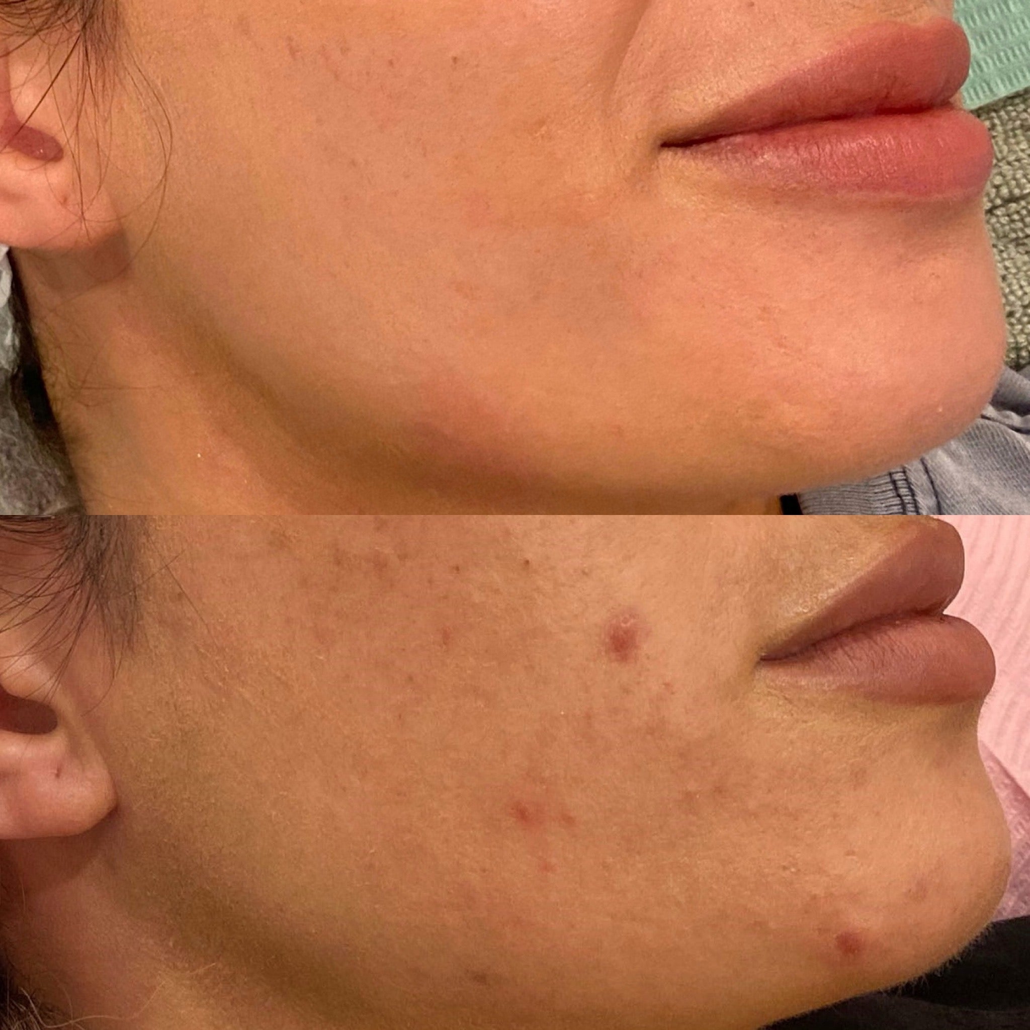 Before and after Image 1