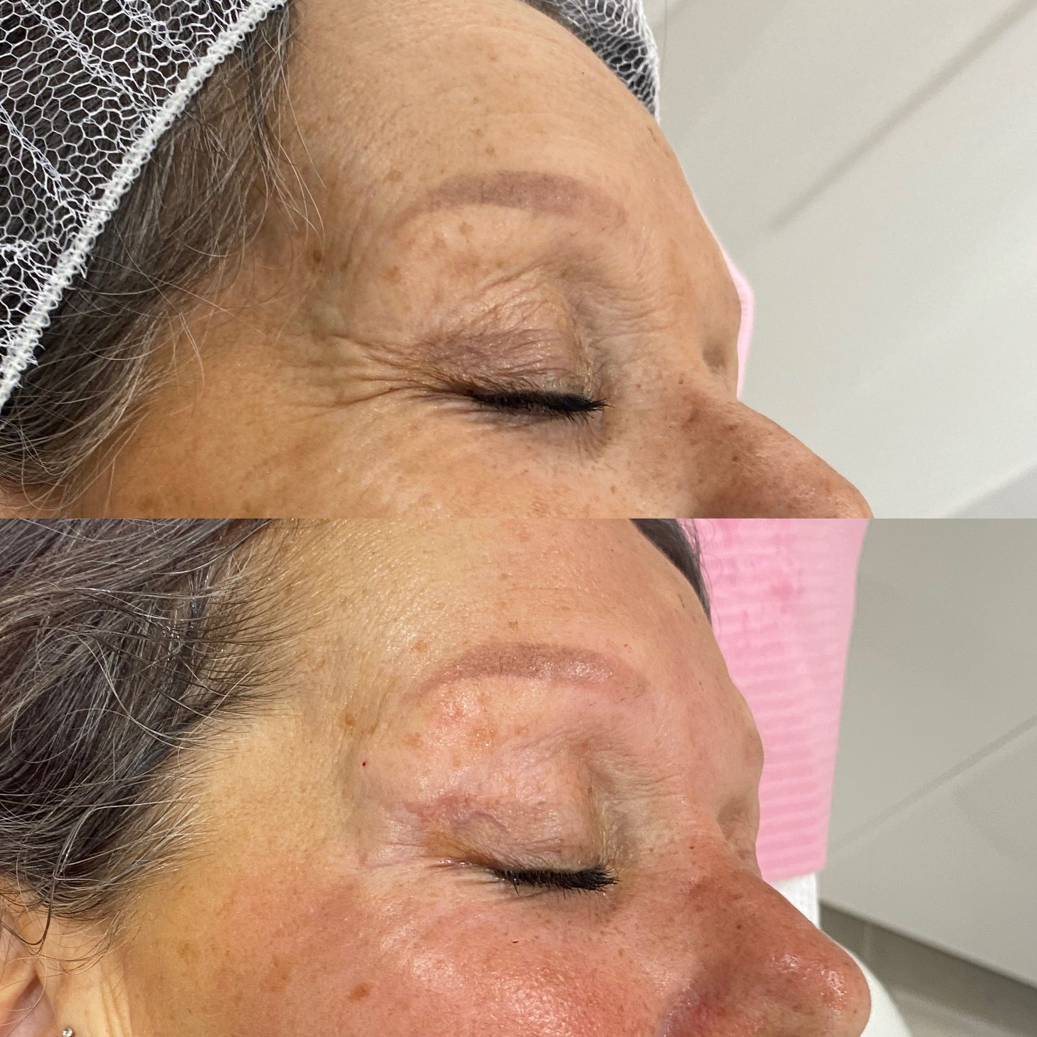 Before and after Image 4