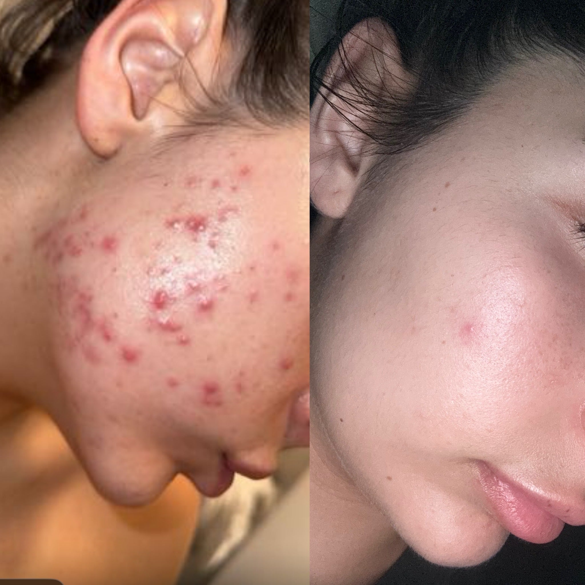 Before and after Image 3