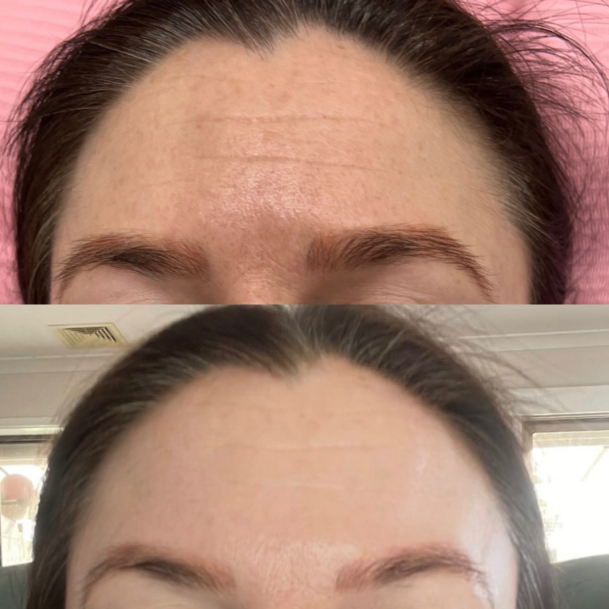 Before and after Image 1
