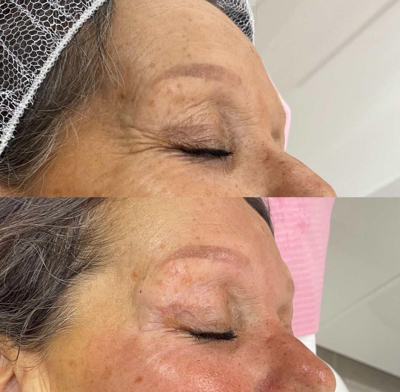 Before and after Image 3