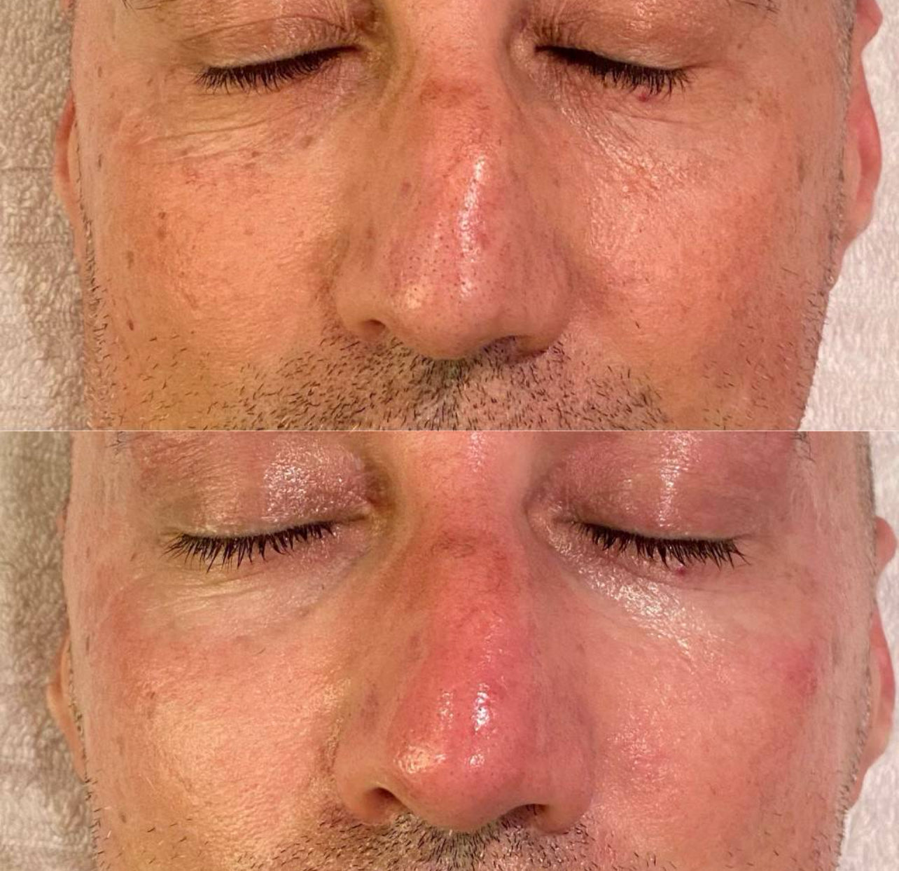 Before and after Image 4
