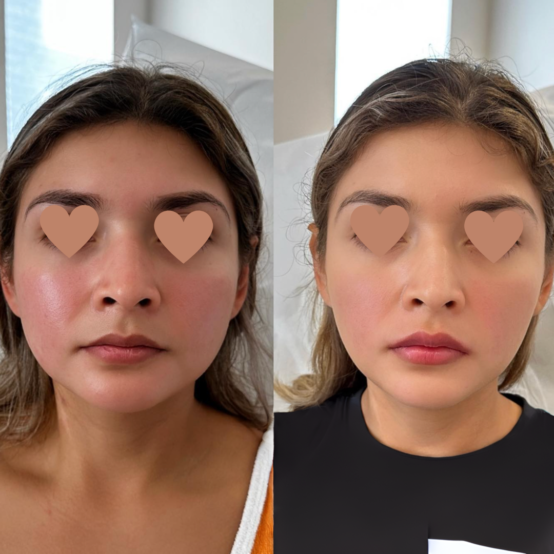 Before and after Image 2