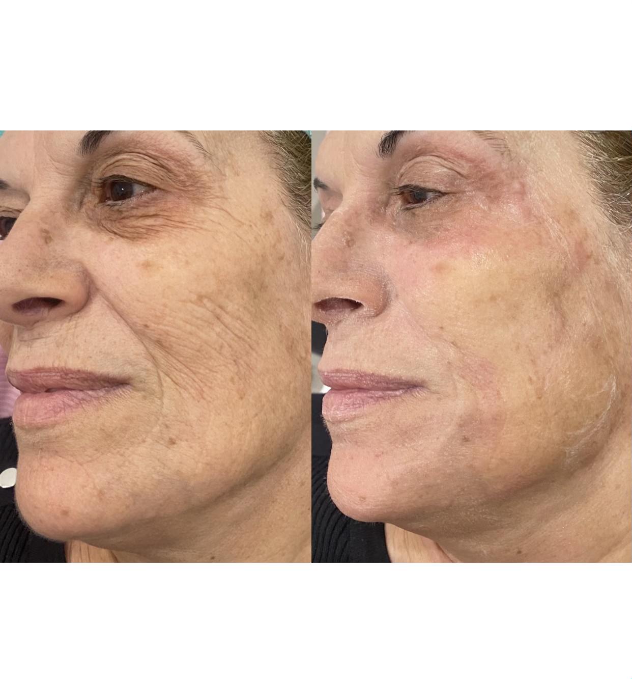 Before and after Image 1