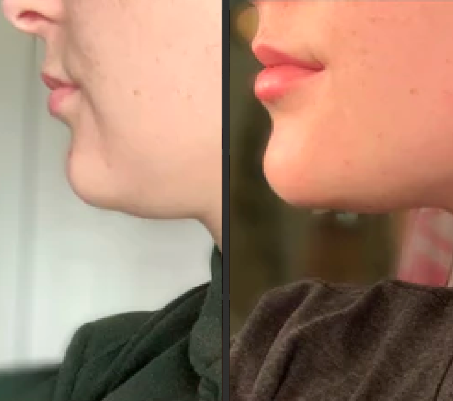 Before and after Image 3