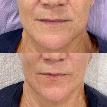 Intense Copper Binding GHK-Cu 5% +Palmitoyl Oligopeptide 0.3% Repair S Double Bay Cosmeceuticals Intense Copper Binding GHK-Cu 5% +Palmitoyl Oligopeptide 0.3% Repair S Double Bay Cosmeceuticals