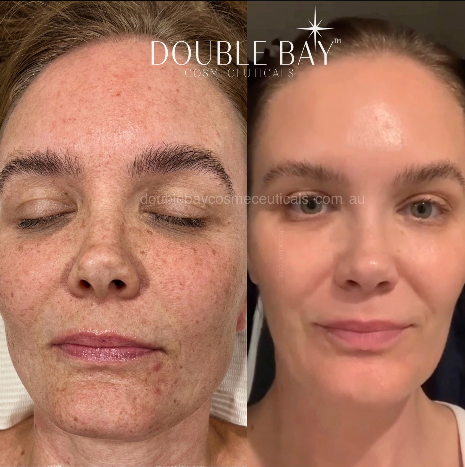 Before and after Image 2