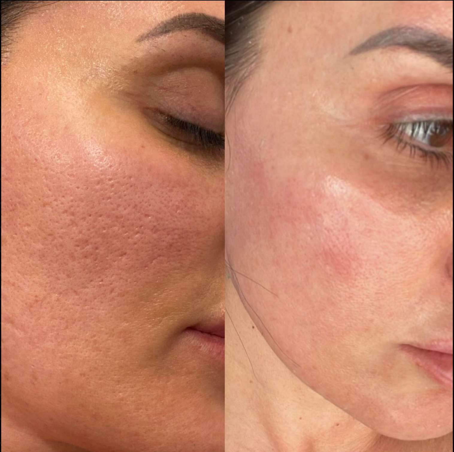 Before and after Image 2