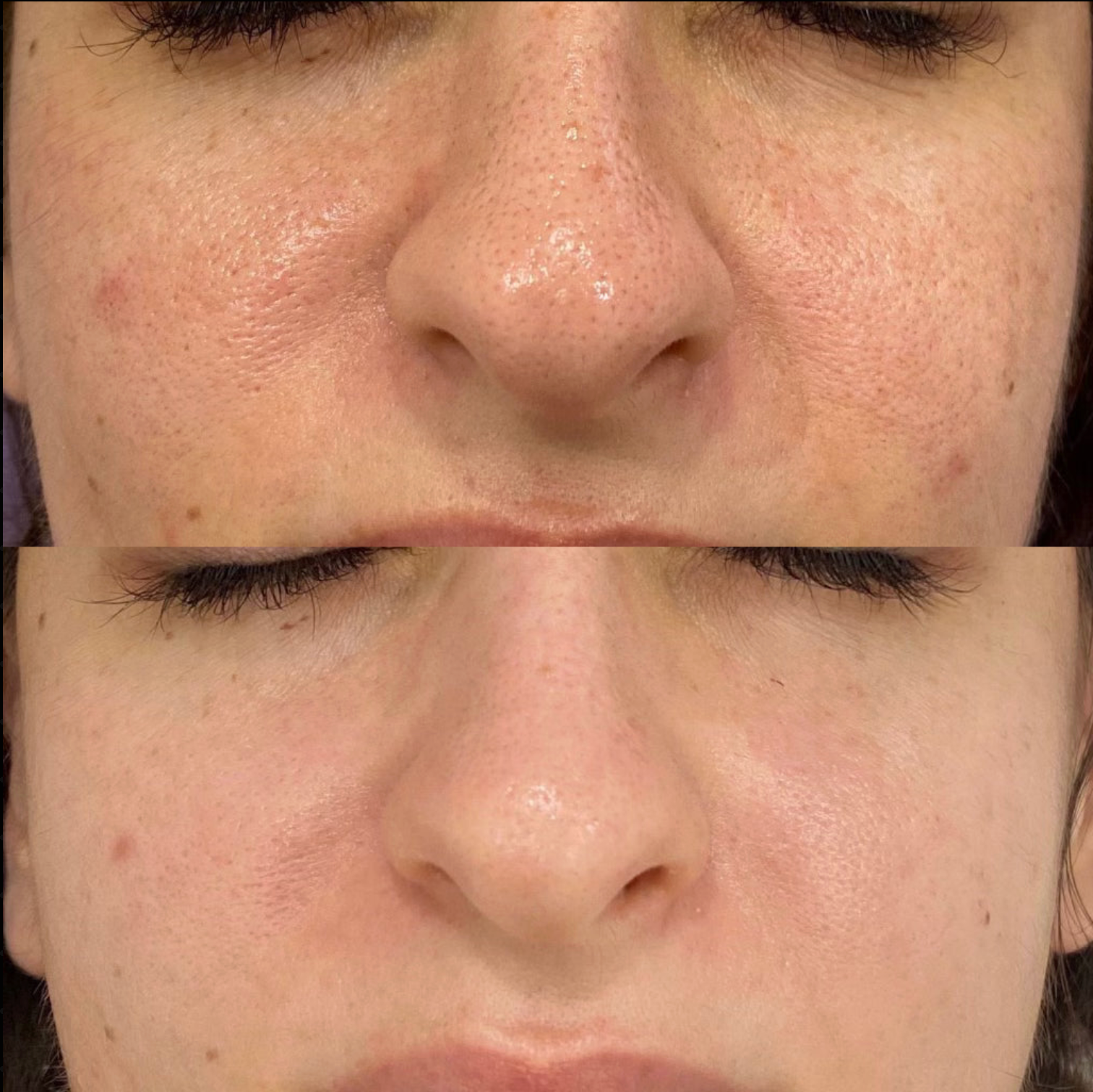 Before and after Image 1